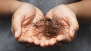 La correlazione tra alcol e caduta di capelli